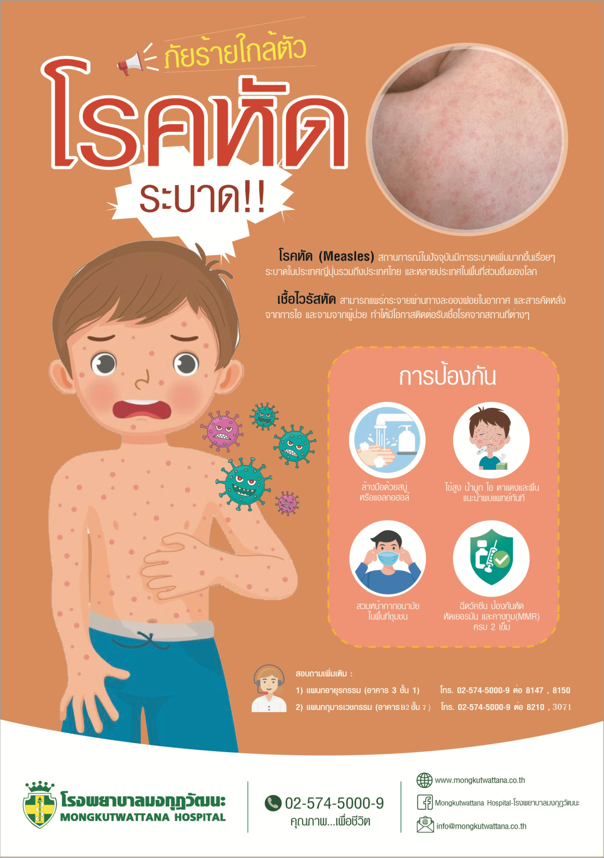 ภัยร้ายใกล้ตัว โรคหัดระบาด